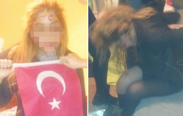 Έξι Τουρκάλες βασάνισαν Κούρδισσα φοιτήτρια και το ανάρτησαν στο WhatsApp (φωτο)