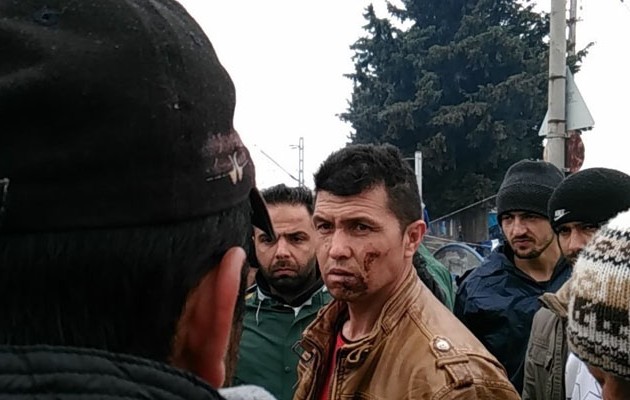 Καταγγελίες προσφύγων: Σκοπιανοί αστυνομικοί μας έκαιγαν στο πρόσωπο