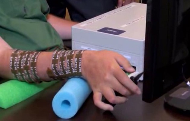 Ιατρικό θαύμα: Αποκατέστησαν κίνηση δαχτύλων, χεριών και καρπών σε τετραπληγικό