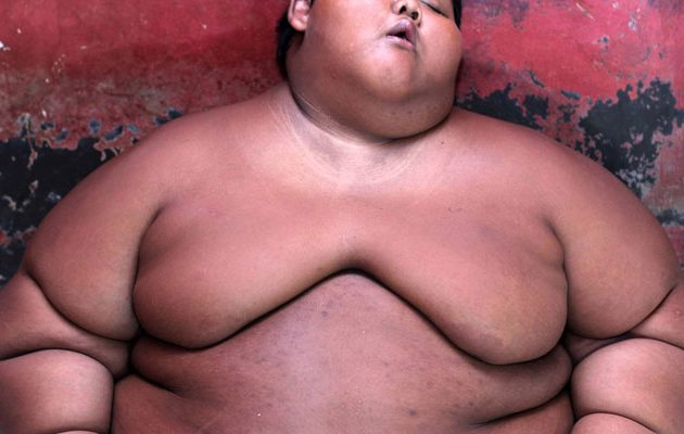 Προκαλεί σοκ η εικόνα: 10χρονος  ζυγίζει 192 κιλά! (φωτο)