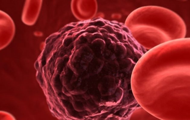 Τεστ αίματος ανιχνεύει τον καρκίνο πριν εμφανιστούν τα κύρια συμπτώματα
