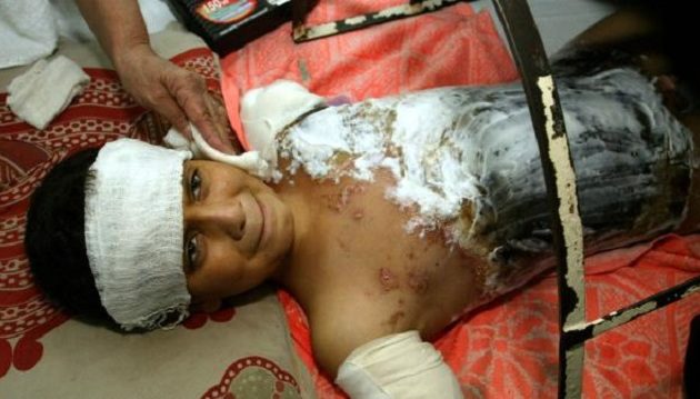 «Είμαι ο μόνος που παρέμεινε ζωντανός από την οικογένεια μου»