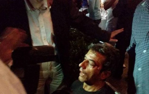 Μολότοφ και ξύλο στην κλήρωση της Football League (φωτο)