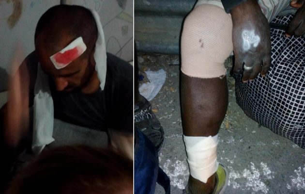 Δόθηκε μάχη μεταξύ προσφύγων στη Μόρια – Δείτε φωτο με τραυματίες