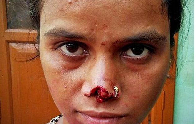 Έκοψε τη μύτη της γυναίκας του επειδή δεν πήρε προίκα!