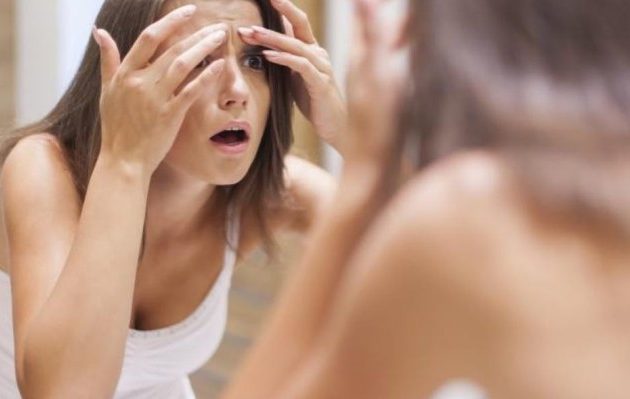 Σε ποια σημεία του προσώπου δεν πρέπει να σπάζετε ποτέ σπυράκια – Κίνδυνος θανάτου!