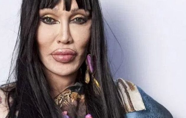 Τον γνωρίζετε; Πέθανε παραμορφωμένος από τις πλαστικές γνωστός τραγουδιστής