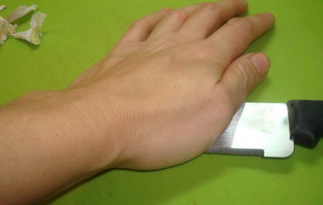 Με ποιο μπαχαρικό μπορείτε να σταματήσετε την αιμορραγία αμέσως