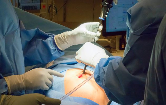 Έναν μίνι-εγκέφαλο “έκρυβε” στις ωοθήκες της μια 16χρονη κοπέλα στην Ιαπωνία