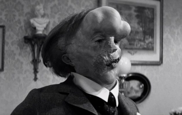 Πέθανε ο Τζον Χερτ,  ο “άνθρωπος ελέφαντας”