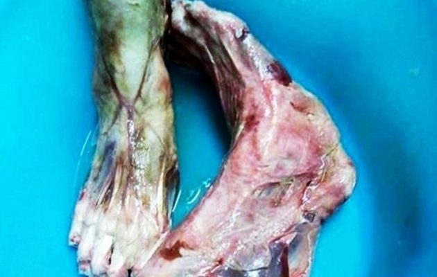 Αυτά τα ανθρώπινα πόδια λέγεται ότι σέρβιρε κινέζικο εστιατόριο στην Ιταλία