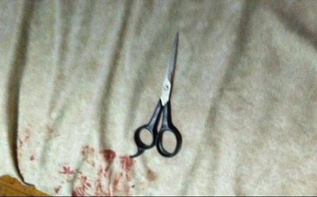 Τσακώθηκαν και τον τραυμάτισε με… ψαλίδι