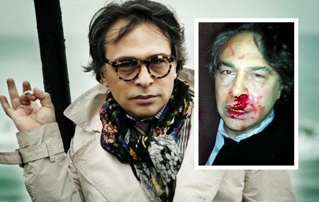 Τούρκος μόδιστρος ξυλοκοπήθηκε άγρια στο αεροδρόμιο Κωνσταντινούπολης (βίντεο)