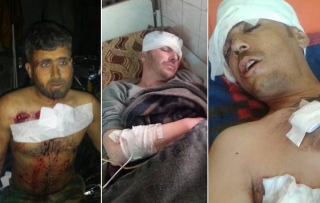 Σύροι στρατιώτες τραυματίες μετά από τουρκικό βομβαρδισμό