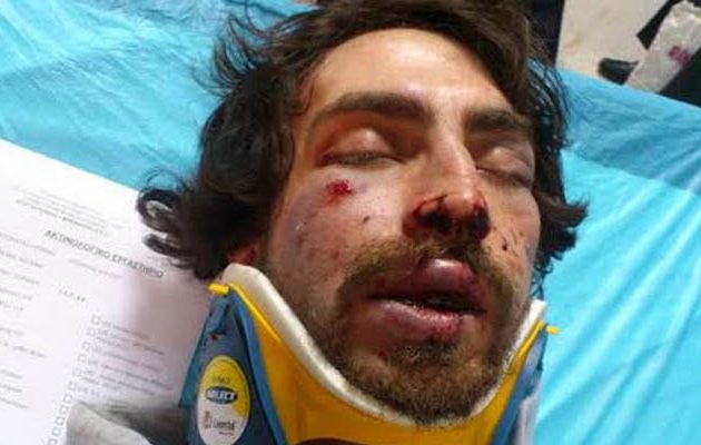 Τάγμα εφόδου της Χρυσής Αυγής ξυλοκόπησε άγρια 20χρονο φοιτητή