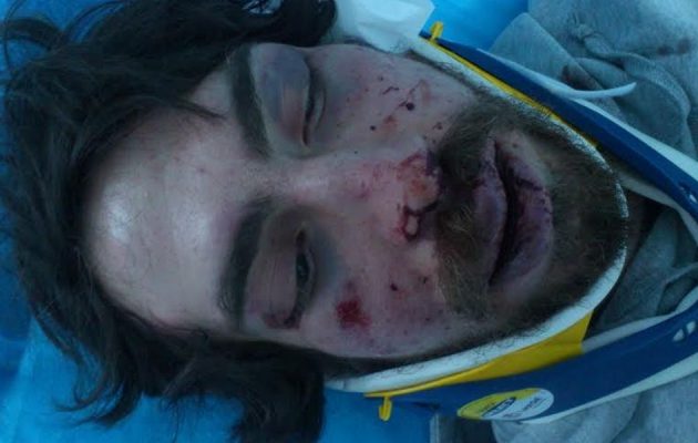 Βαριές κατηγορίες για τον μετακλητό του Μιχαλολιάκου για φονική επίθεση σε φοιτητή