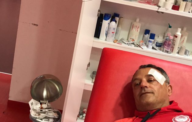 Οργή Ολυμπιακού για την απρόκλητη αστυνομική βία στο Καραϊσκάκη (φωτο+βίντεο)