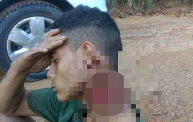 Βραζιλία: Με κομμένο λαιμό περπάτησε μισο-αποκεφαλισμένος για να σωθεί (βίντεο)