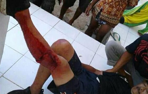 ΣΟΚ: Τεράστια σαύρα επιτέθηκε σε τουρίστα στην Ινδονησία (βίντεο)