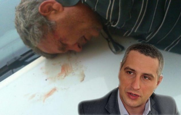 Παππούς πυροβόλησε τον απερχόμενο υπουργό Υγείας των Σκοπίων