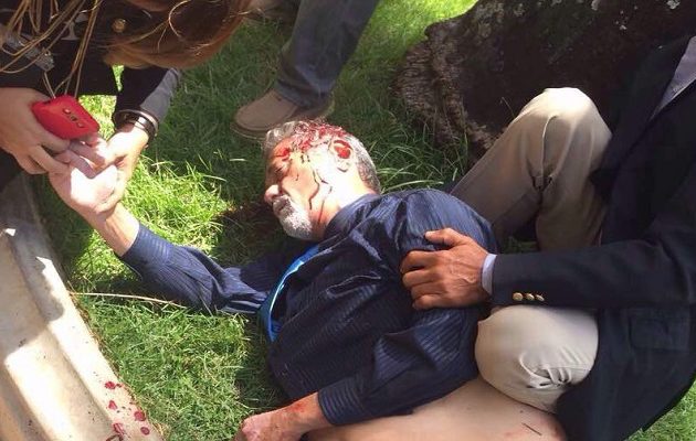 “Nτου” οπαδών του Μαδούρο με ρόπαλα στο κοινοβούλιο – Τραυμάτισαν βουλευτές (φωτο)