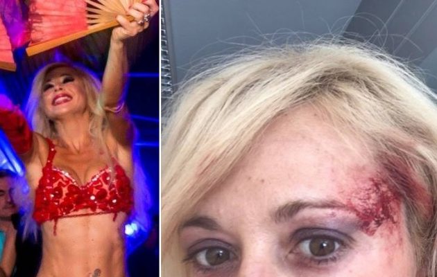 Ξυλοκόπησαν τη χορεύτρια της κοιλιάς Αλεξάνδρα Φωτεινού (φωτο)