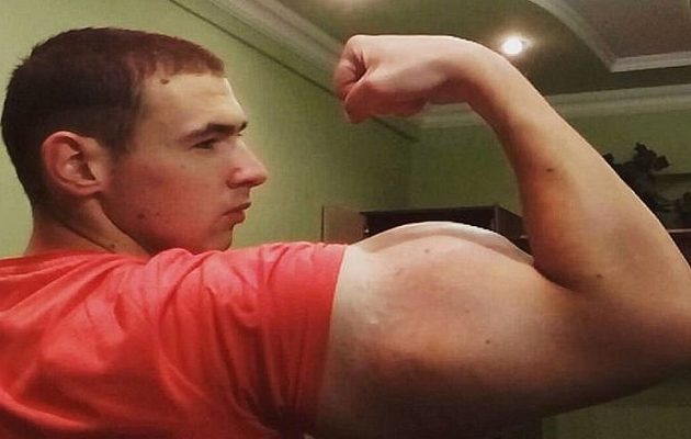 21χρονος Ρώσος έκανε “μπράτσα” με παυσίπονα και αλκοόλ (βίντεο)