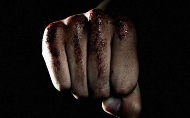 Σοκ στον Έβρο: Αδέλφια έδεσαν 46χρονο σε δέντρο για να τον σπάσουν στο ξύλο