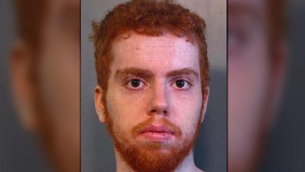 Aπίστευτο: Άνθρωπος δάγκωσε σκύλο και του έβγαλε το μάτι!