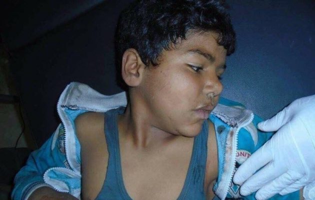 Ο εννιάχρονος Γιαχία το πρώτο παιδί που σκότωσαν οι Τούρκοι στην Εφρίν