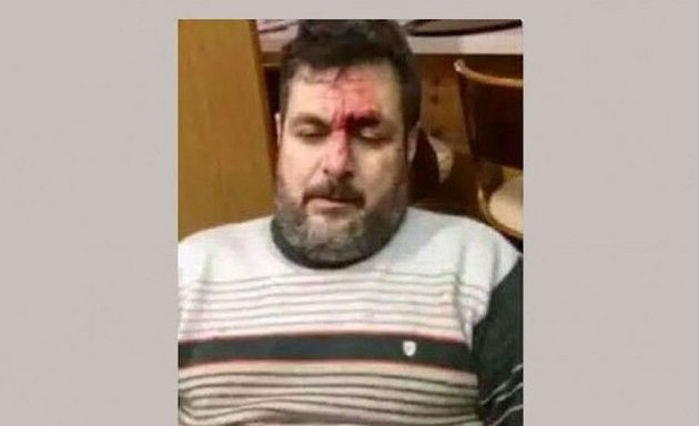 Πλάκωσαν στο ξύλο οπαδό της ΑΕΚ – Του έσπασαν μύτη και πλευρά