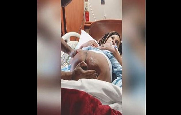 Γιατρός ζουλάει την κοιλιά εγκύου και γυρνάει το παιδί (βίντεο)