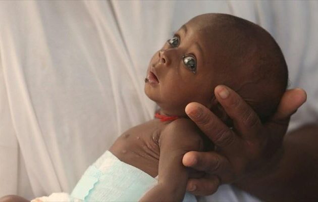 UNICEF: «Αθέατη τραγωδία» από την αύξηση των θανάτων βρεφών σε φτωχές χώρες