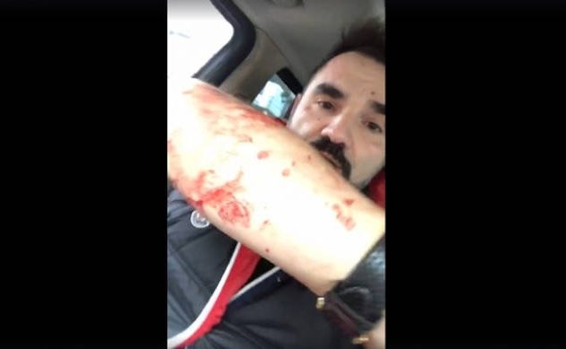 Προσπάθησαν να σκοτώσουν με σφυριά τον δημοσιογράφο Νάσο Γουμενίδη (βίντεο)