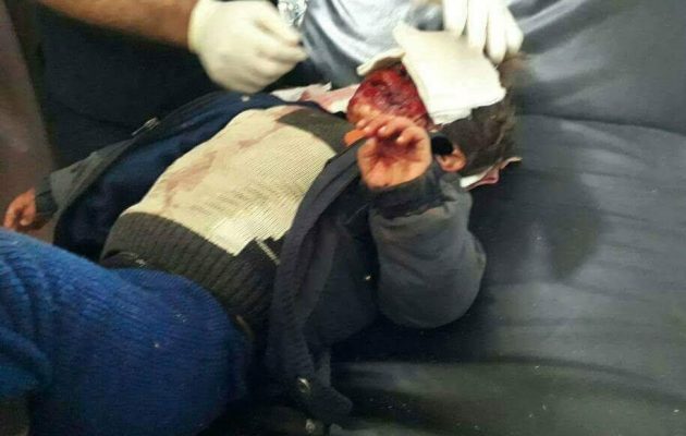 Εικόνες ΣΟΚ! Οι Τούρκοι σφαγιάζουν αμάχους και μωρά στην Εφρίν (φωτο+βίντεο)