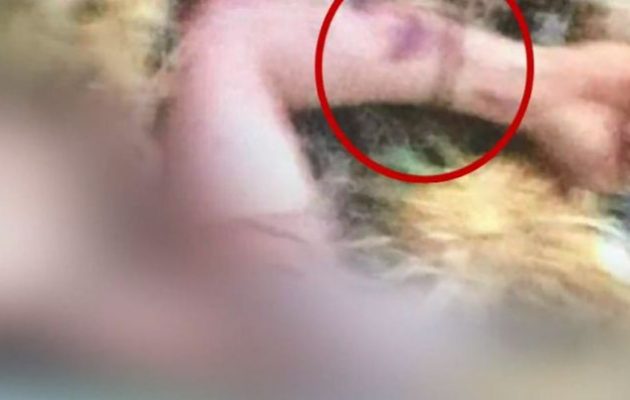 Ανατροπή: Φωτογραφία αποκαλύπτει σημάδια στα χέρια του άτυχου φοιτητή στην Κάλυμνο (φωτο)