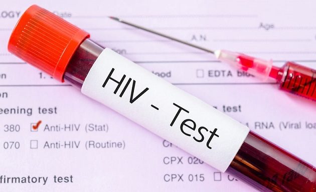 Σε ποια χώρα θα γίνονται ατομικά τεστ αυτοδιάγνωσης του ιού HIV από τα φαρμακεία