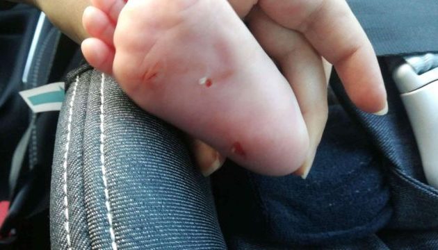 Σοκάρουν οι αποκαλύψεις για τη μανιακή που χαράκωνε μωρά στην Αθήνα