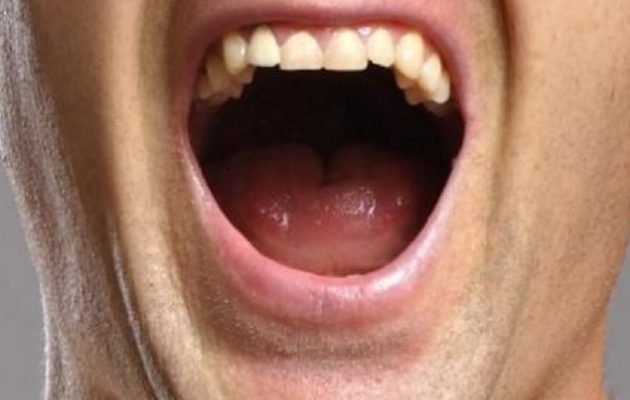 Απίστευτο: 74χρονος στον Βόλο σε κατάσταση αμόκ δάγκωσε τη γυναίκα του