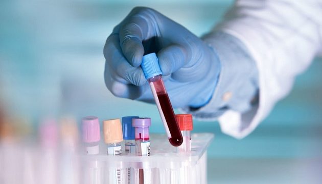 Tεστ αίματος ανιχνεύει DNA από οκτώ διαφορετικές μορφές καρκίνου