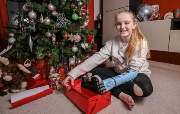 Ανώνυμος δωρητής χάρισε βιονικό χέρι σε 11χρονη – Γεννήθηκε χωρίς το αριστερό άνω άκρο