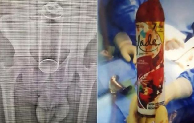 40χρονος «μερακλής» ζήτησε από τη γυναίκα του να του «χώσει» ένα αποσμητικό και κατέληξε στο χειρουργείο (φωτο)