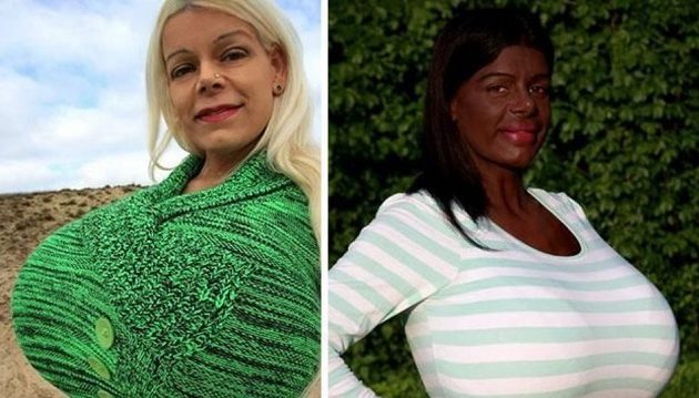 Η 28χρονη με τα μεγαλύτερα στήθη στην Ευρώπη τώρα θέλει να αποκτήσει καφέ δέρμα (βίντεο)