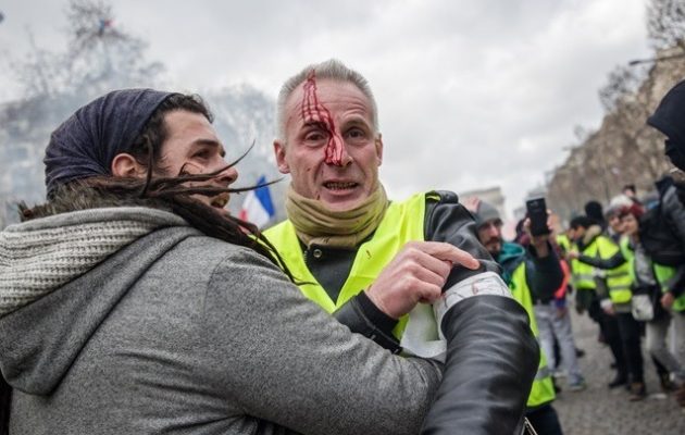 «Κίτρινα γιλέκα»: Πεδίο μάχης το Παρίσι – Ένας διαδηλωτής με κομμένα δάχτυλα
