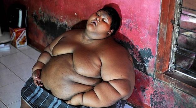 Το πιο χοντρό παιδί του κόσμου έχασε 80 κιλά (φωτο)