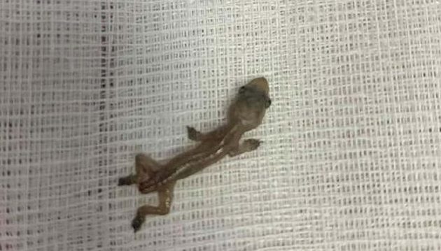 Aπίστευτο: Γιατρός ανακάλυψε σαύρα στο αυτί ασθενούς