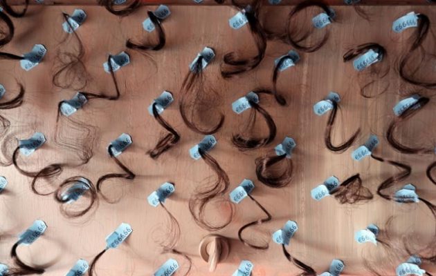 Η μεταμόσχευση μαλλιών φέρνει κέρδη στην Τουρκία – Στο 1 δισ. ο τζίρος