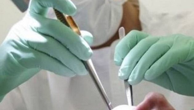 32χρονη έκανε εξαγωγή δοντιού και έπεσε σε κώμα