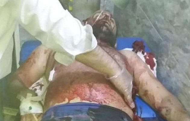 Νεκροί και τραυματίες χριστιανοί από τις τουρκικές βόμβες στο Καμισλί (φωτο+βίντεο)