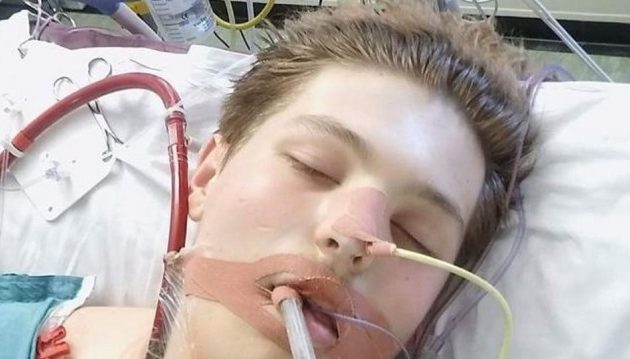 19χρονος κόντεψε να πεθάνει από το άτμισμα – Κατέρρευσαν μέσα σε μήνες οι πνεύμονές του